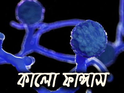 ব্ল্যাক ফাঙ্গাস